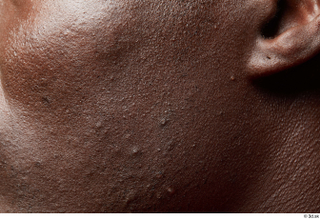 HD Face Skin Kato Abimbo cheek ear face skin pores…